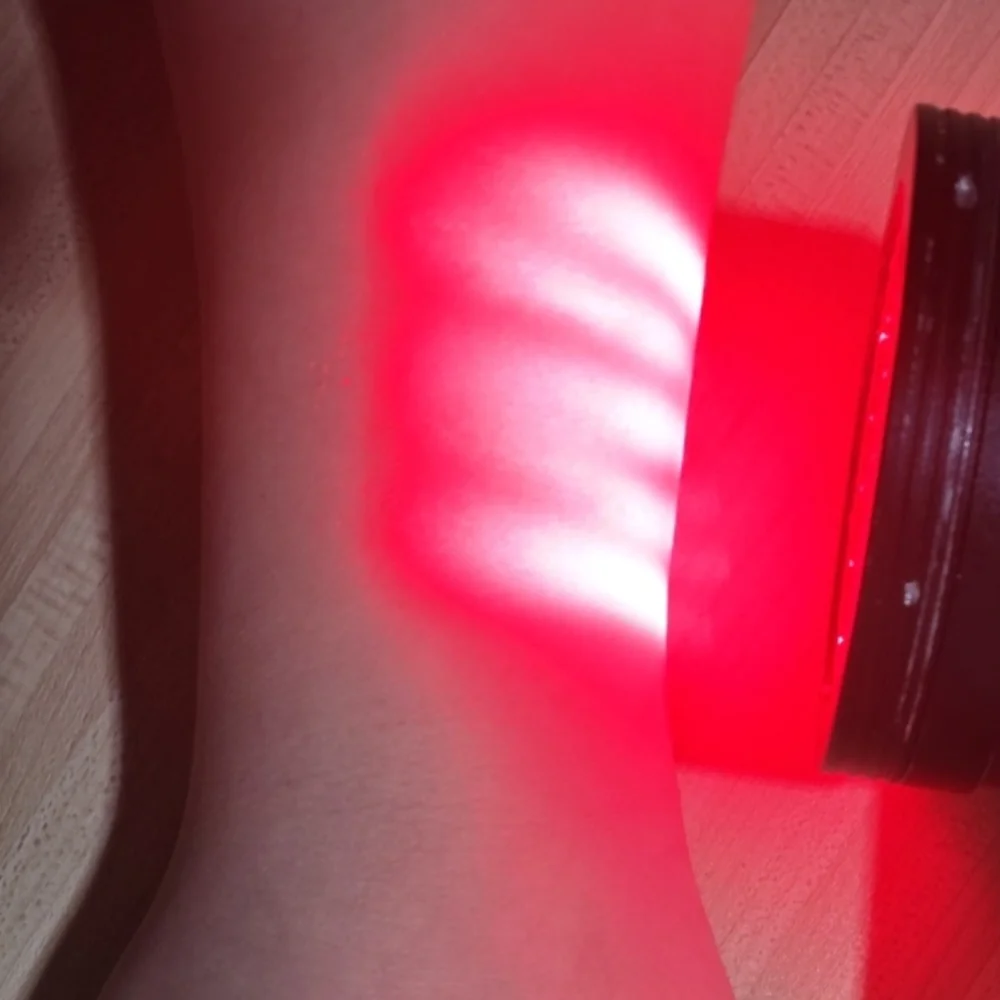 

Медицинская лазерная терапевтическая система класса IV мощностью 5 Вт, массив 19x950 нм + 6x808 нм для лечения диабетической невропатической боли, дискогенной боли и