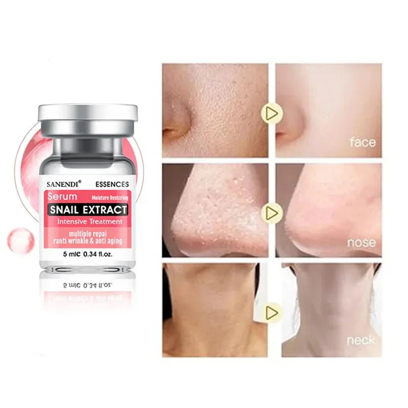 Siero di acido ialuronico con fiala a sei peptidi per il viso Dr Pen SNAIL ACNE Soluzione Riparazione idratante Cura della pelle Scatola coreana da 10 pezzi