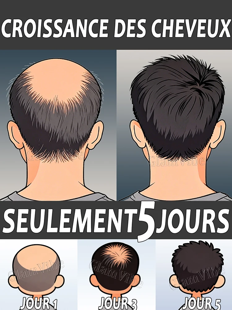 

Anti hair loss essence, deeply care hair root, accelerate hair growth, thicken hair, remove dandruff