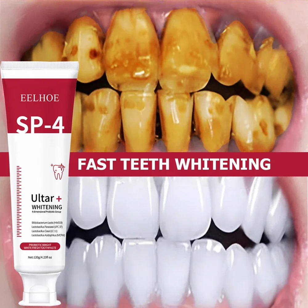 

SP-10 Effective Teeth Whitening Toothpaste Probiotic Remove Plaque Stains Anti-decay Fresh Bad Breath Dental Cleaning Tools Care