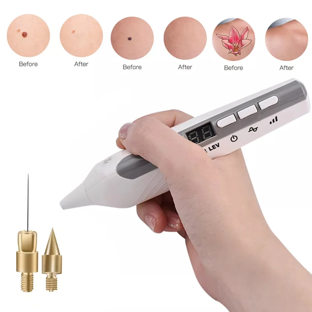 Professionelles 9-Stufen-LCD-Display Fibroblast-Plasma-Pen Augenlidstraffung Hautflecken-Entferner Muttermale Warzenentferner Schönheitsgerät für Zuhause – Detail 7