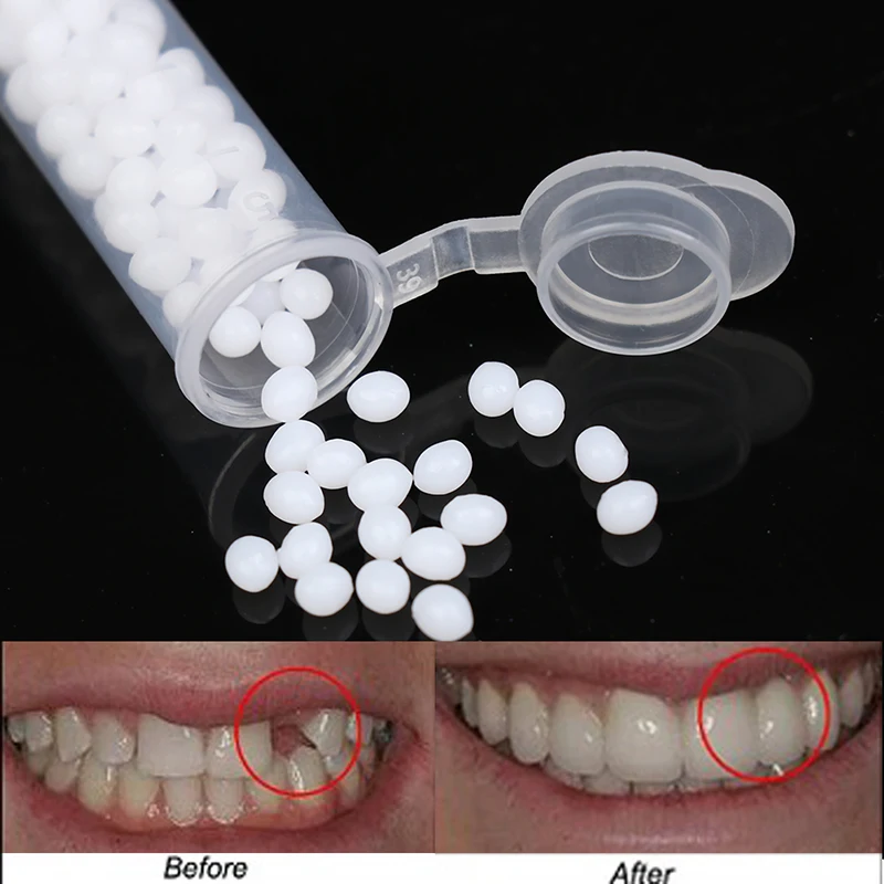 1 scatola Kit di riparazione temporanea dei denti denti e spazi vuoti denti finti colla solida strumento di bellezza dei denti dentiera adesivo sbiancamento dei denti