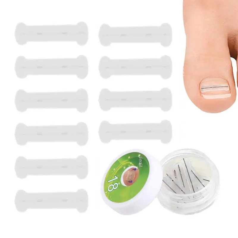 1 Stuks Teennagel Corrector Patch Ingegroeide Teennagel Patches Corrector Pedicure Tool Veilig Draagbare Flexibele Ingegroeide Teennagel Patches