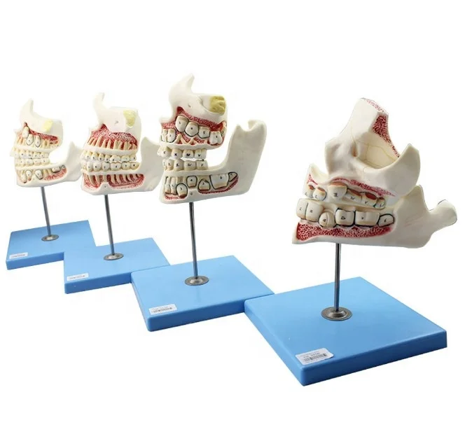 Anatomical models of human teeth and jaws for dentals teaching and medical research