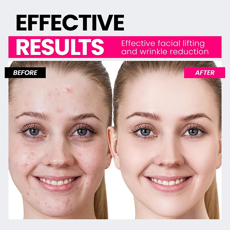 Microcurrent Facial Device,Latest Red Light Technology,Facial Wrinkle Equipment,Smart Photon Micro-Current Device to Lift Face