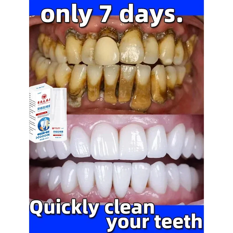 Dental Calculus Remover Teeth Whitening Spray Toothpaste Cleaning Oral Hygiene Removal Halitosis Plaque Stains Fresh Breath Care