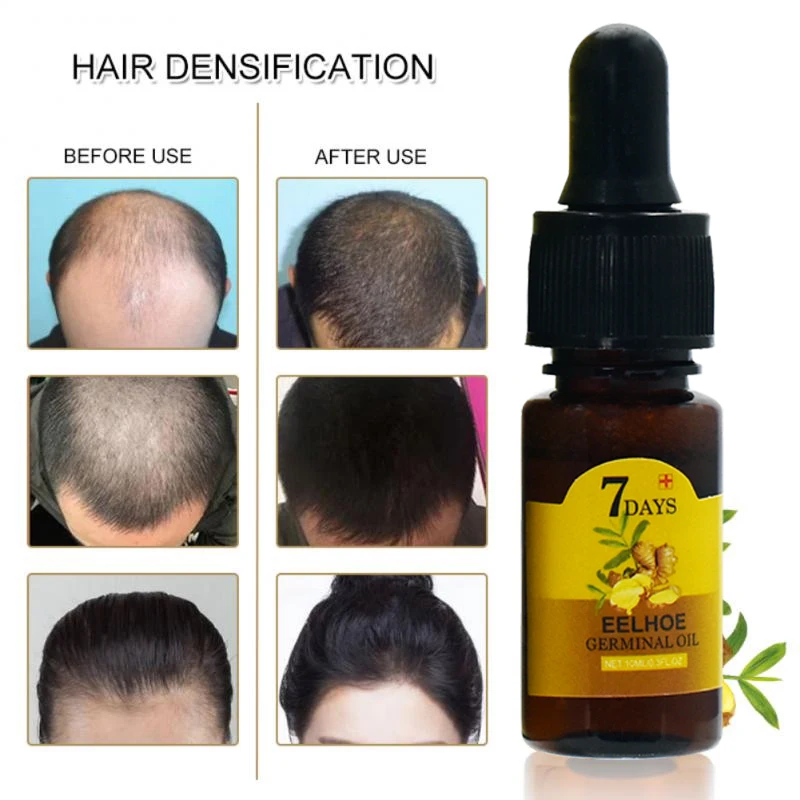 Ginger Hair Growth Essential Oils Serum Fast Hair Regrowth 7 Days Anti-loss Repair Damaged Hair Strong The Root of Hair Care view 6
