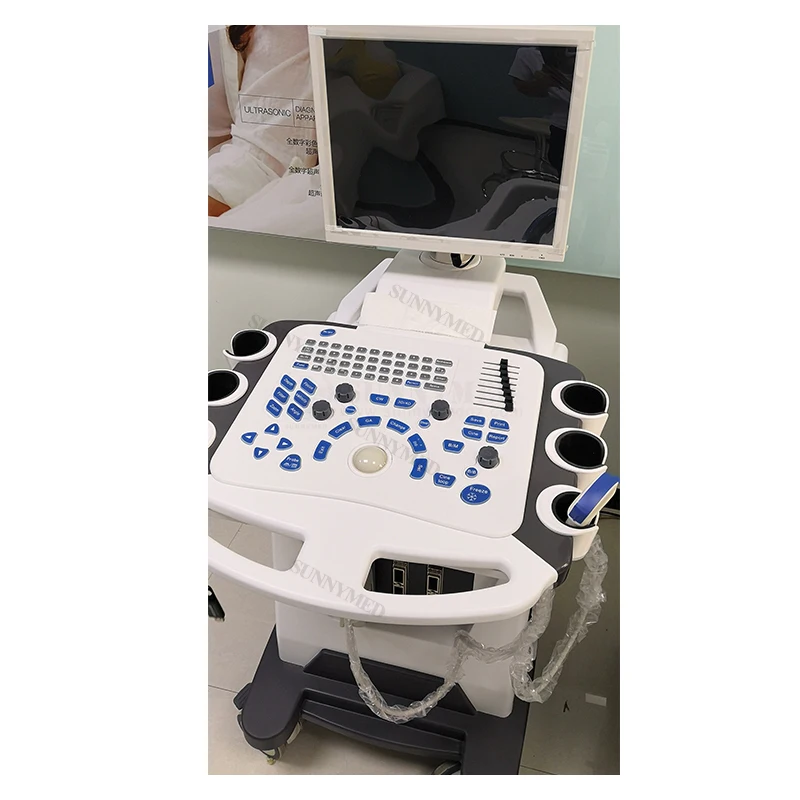 Sy-A028C Ultrasound Scanner Multi-Operating Mode Medical Gynecology Trolley Color Doppler Ultrasound Scanner with 17