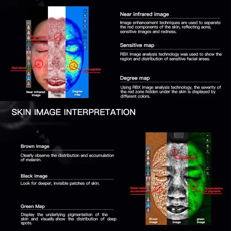 高品質ポータブル顔肌分析スキンモニターアナライザーテスター3Dデジタルスキンアナライザーマシン
