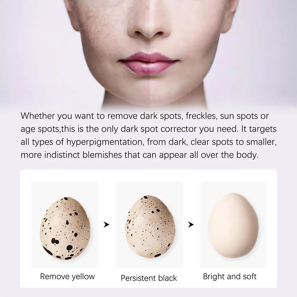 สีเขียวครีมสมุนไพรครีมบํารุงผิวหน้าลบกระPigment Skin Face Care Decomposition G1N3