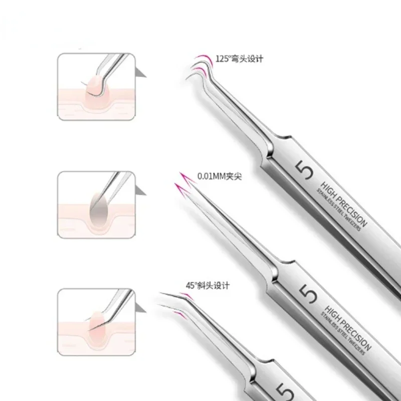 German Ultra-fine No. 5 Cell Pimples Blackhead Clip Tweezers Beauty Salon Special Scraping & Closing Artifact Acne Needle Tool