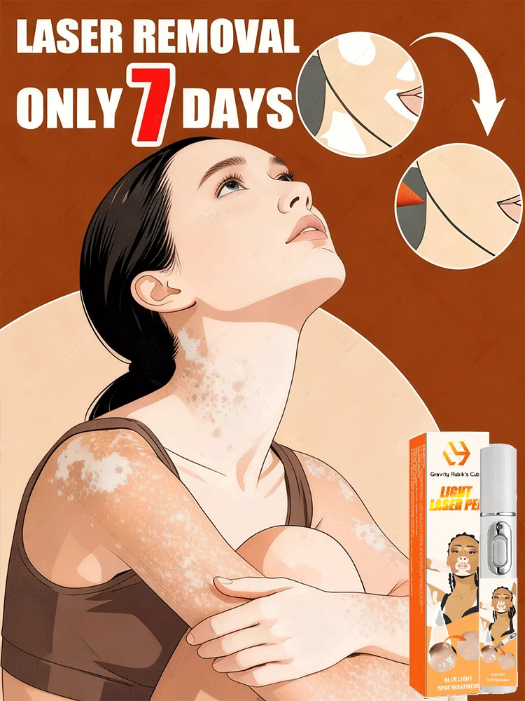 Bolígrafo de luz azul para Vitiligo, gran oferta 20225, herramientas para el cuidado del Vitiligo, unisex, generación-2, juego combinado de comidas