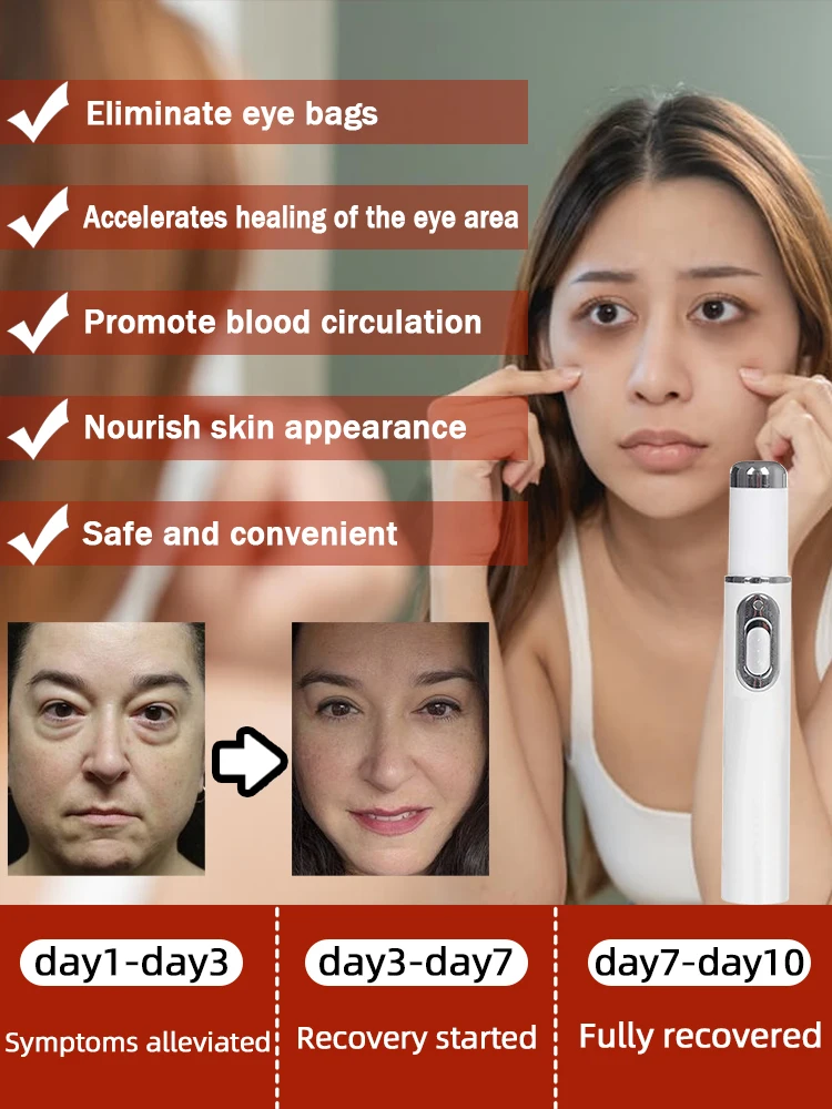 Laser Pen for Dark Circle and Eye Bag Removal