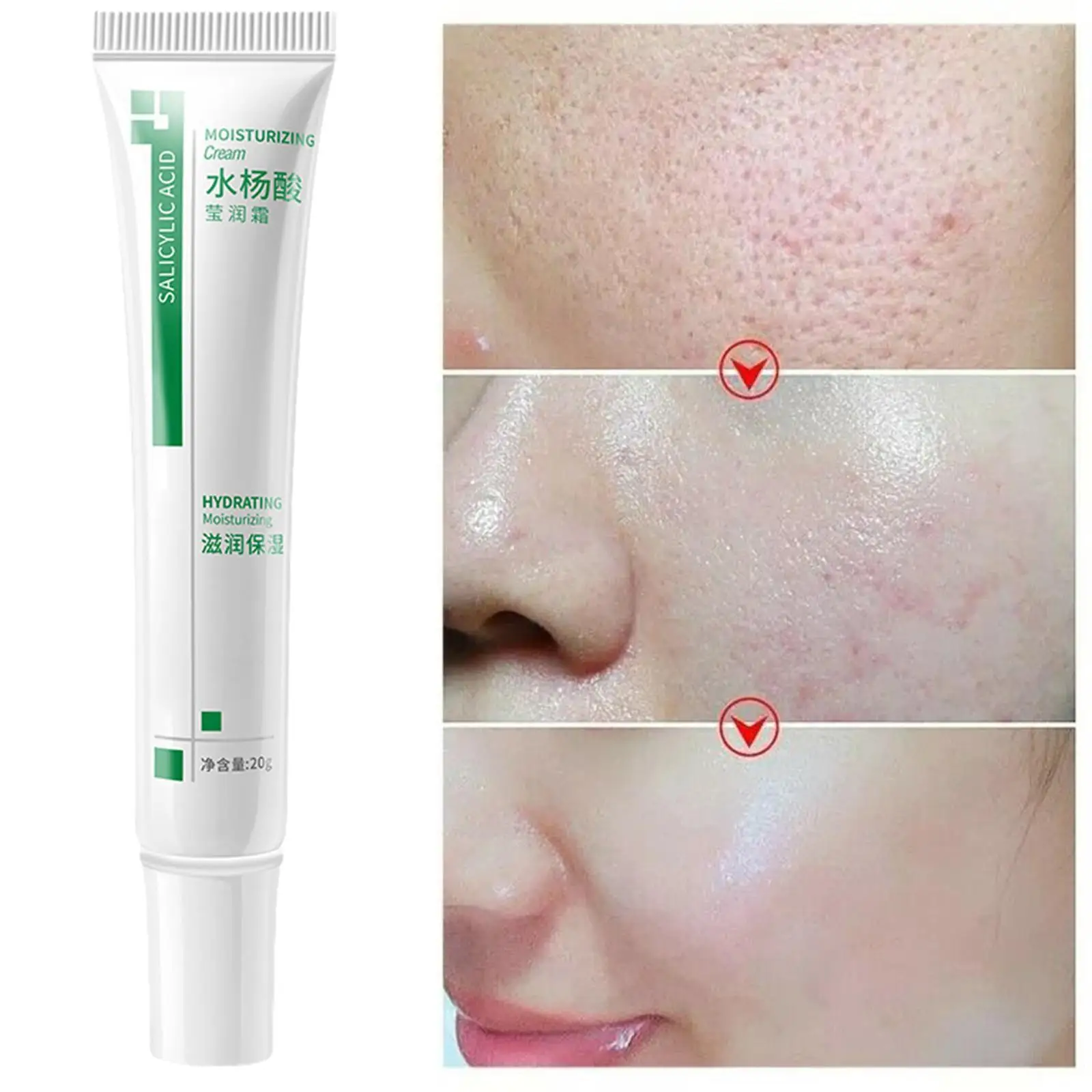 

3PCS Salicylic Acid Pores Shrink Cream Refining Large Pore Improve Face Acnes Blackhead Remove Cream Anti-aging Oil Control