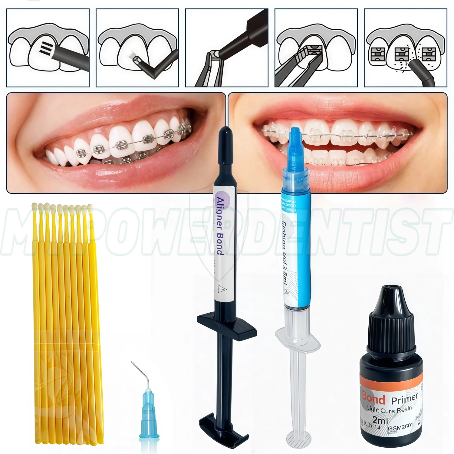 

Dental Light Cure Orthodontic Adhesive Paste for Aligner Attachments 2.5g Kit