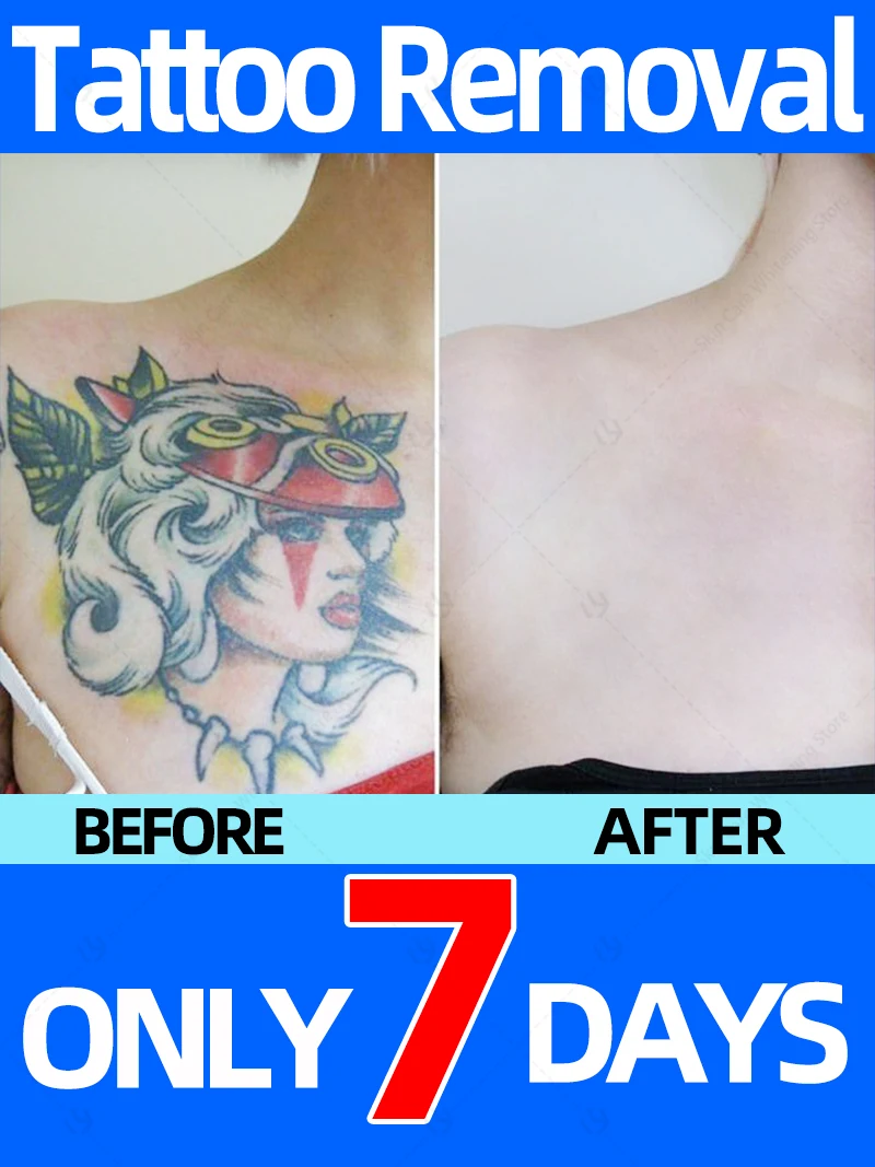 

Fast and safe Tattoo fading
