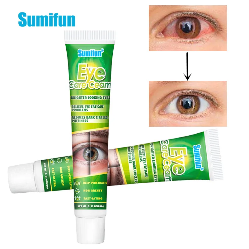 20g Chinese Herbal Medicine Eye Care Cream Brighter Looking Eyes Relieve Eye Fatigue Problems Eyes Red Blood Clear