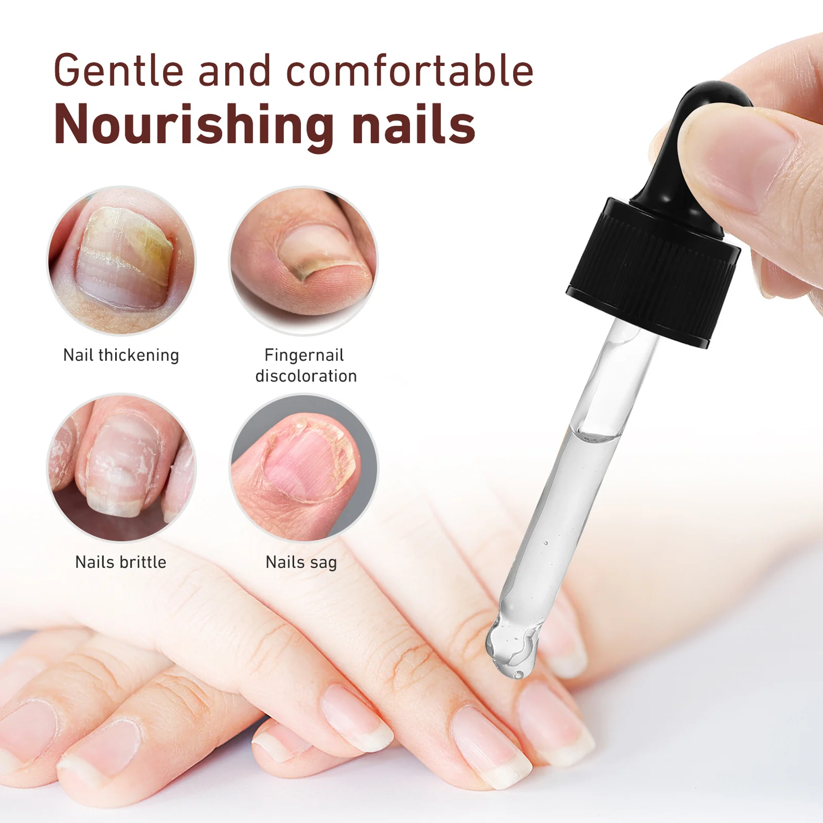 Teennagelbehandeling Extra sterkte nagelreparatievloeistof voor schimmelnagels Verkleuring Gebarsten teennagel Vingernagel