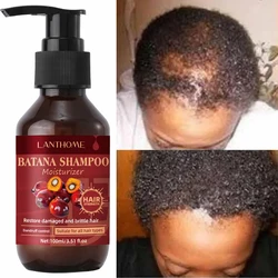 Batana Hair Growth Shampoo, Hair Loss Treatment, Produtos Eficazes em 7 dias, Puro e Natural, Hair Loss Treatment