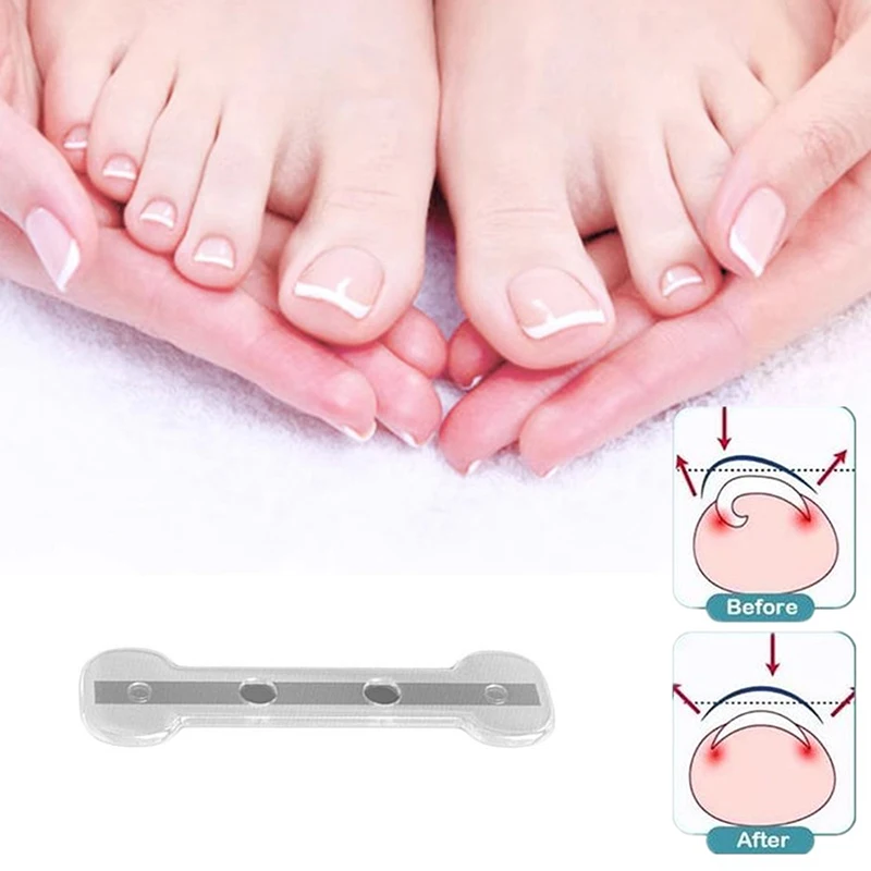 Ingrown Toenail Correction Tool Ingrown Toe Nail Treatment Elastic Patch Sticker Straightening Clip Brace Pedicure Tool