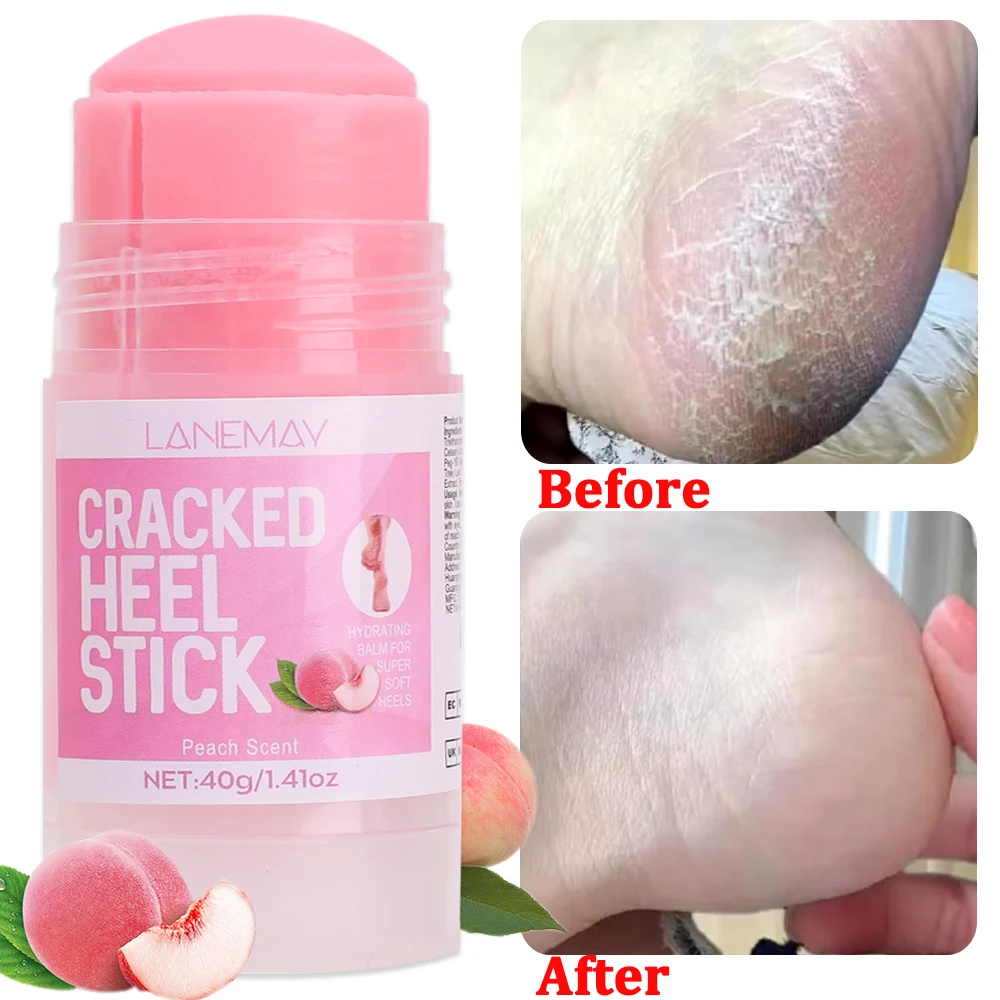 Moisturizing Foot Care Cream Preventing Cracking Cracked Feet Cream Stick Easy To Absorb Gentle Exfoliation Daily Foot Care Tool