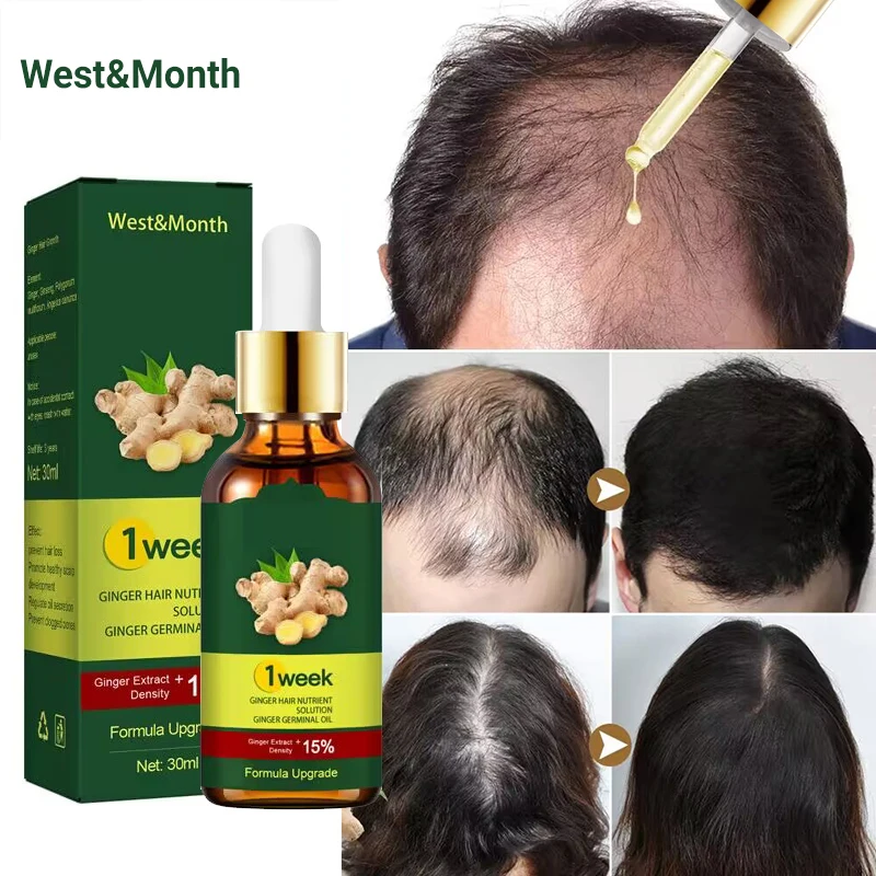 Anti-Hair Loss Óleos Essenciais, Produtos para o Crescimento Do Cabelo Gengibre, Rápido Promover Soro De Rebrota Do Cabelo, Tratamento Do Couro Cabeleireiro, Cuidado Da Calvície, 7 Dias