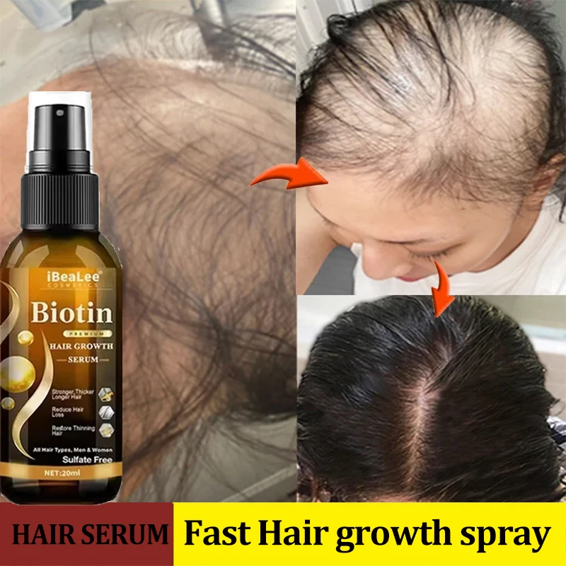 

Biotin Hair Growth Serum Spray Anti Hair Loss Oil Prevent Baldness Nourish Scalp Roots Repair Damaged Hair Beard Care Products