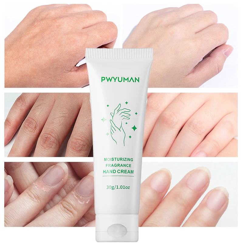 Dry Skin Hand Cream Whitening Soothing Repairing Lasting Moisturizing Dead Skin Removal Anti Cracking Hand Care Moisturizer 30g