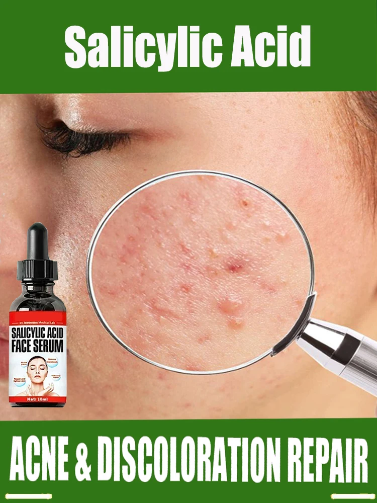 

Salicylic Acid Solution Essence 10mL Shrink pores and Acne Spot Removing Shrink Pores Oil-Control Brighten Face Skin Makeup