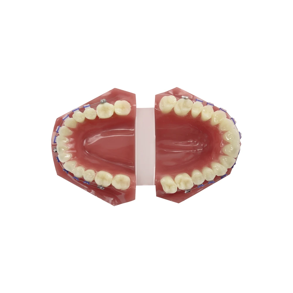 Model do ćwiczeń stomatologicznych w trybie leczenia ortodontycznego pół-metalowa półceramiczna orto proteza do drutu standardowego Model nauczania