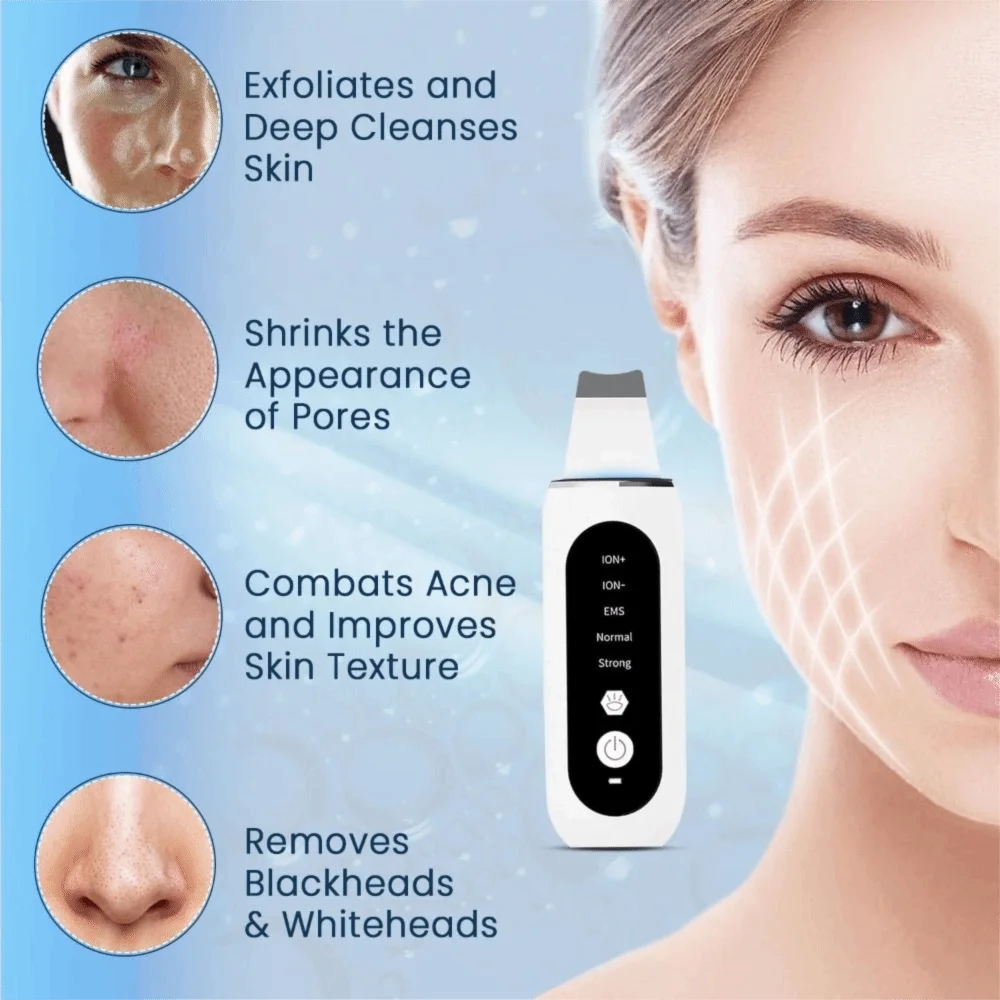 Scrubber ad ultrasuoni per la pelle Spatola per il viso Pulizia profonda 5 in 1 Rimozione di punti neri Macchina per raschiare il viso elettrica Attrezzatura di bellezza