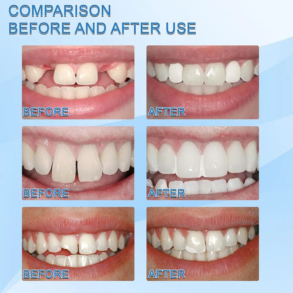 Tymczasowa naprawa zębów Moldable Tooth stały żel klej fałszywe zęby makijaż Gutta Percha Moldable sztuczne zęby dla kobiet mężczyzn