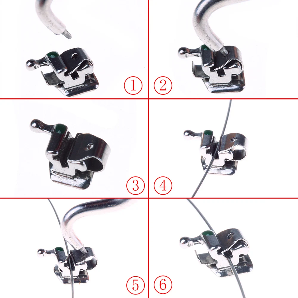 AZDENT Zahnspangen, kieferorthopädische Zahnspangen, Metall, aktiv, selbstligierend, Mini Roth 0,022 Haken, 3–4–5 Bukkalröhrchen, Zahnmedizin-Werkzeug – Detail 5