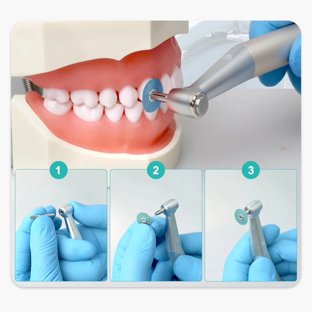 SYJH Dental Flexível Polimento Discos, Acabamento para Cerâmica e Restaurações de Iômeros de Vidro, CYW069, 80 Unidades por Caixa