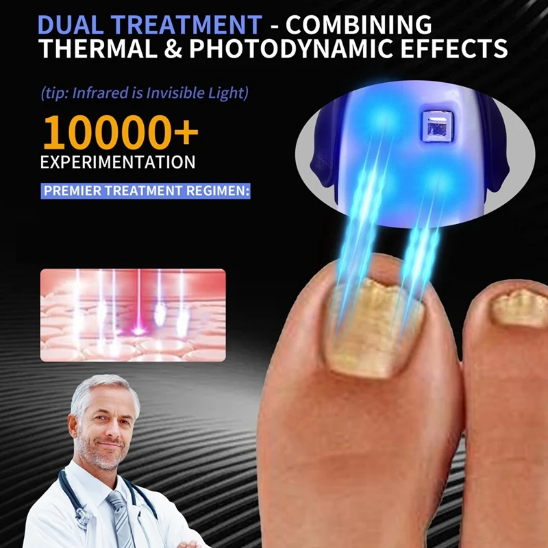 NEW_ جهاز العلاج بالليزر لفطريات الأظافر للعلاج أ