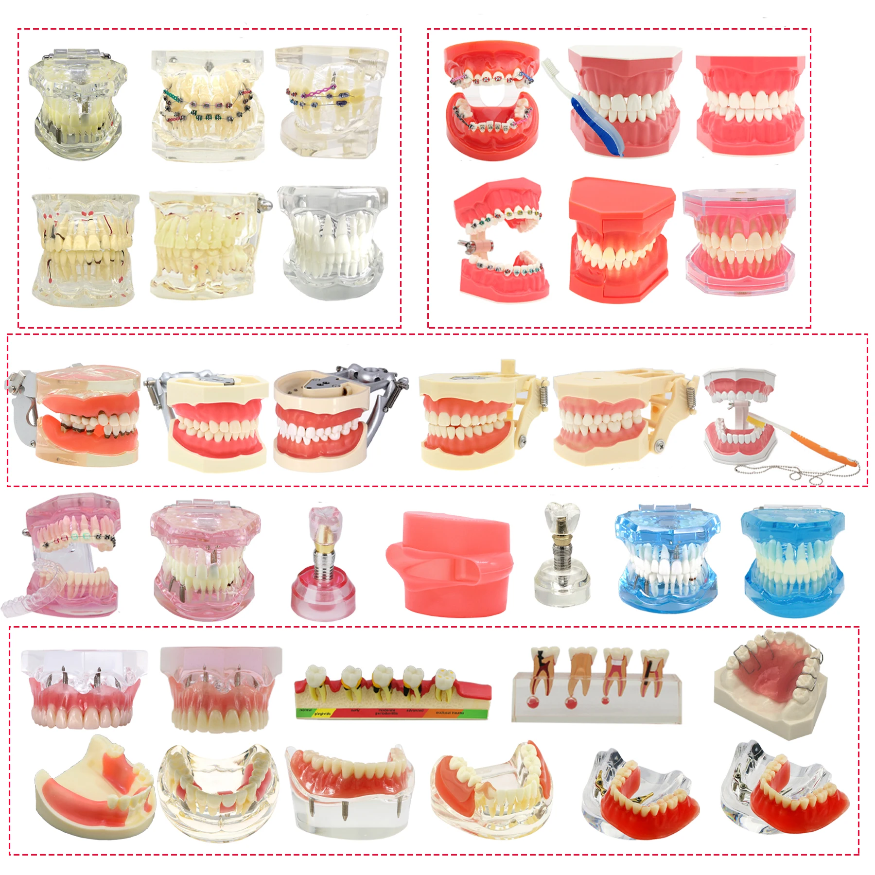 Dental Teeth Model Implant Model Multiple Types Dentistry Teaching Models Orthodontic Removable For Patient Education Demo