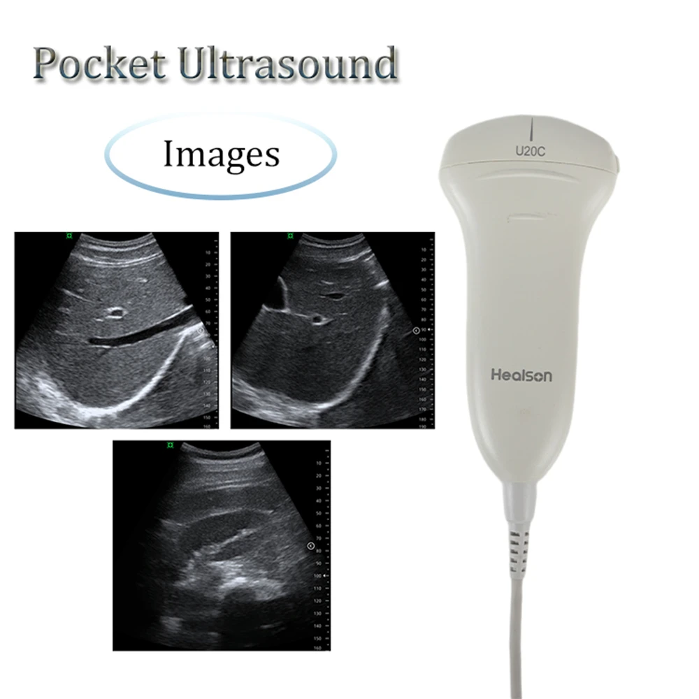 1pc Pocket Ultrasound Multi-elements Scanner Ultrasound Probe Support Smart Phone Andriod Windows System