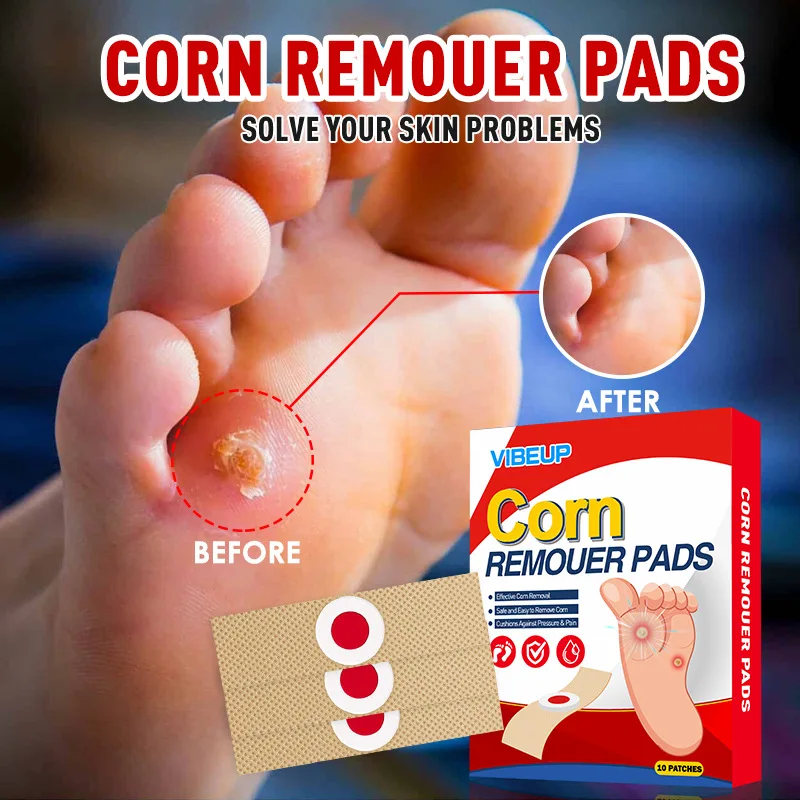 Corn Foot Toe Heel Callus Dead Skin Relief Cleaning Care Patches Adhesive Callus Cushion Non-woven Fabric Toe Corns Removal