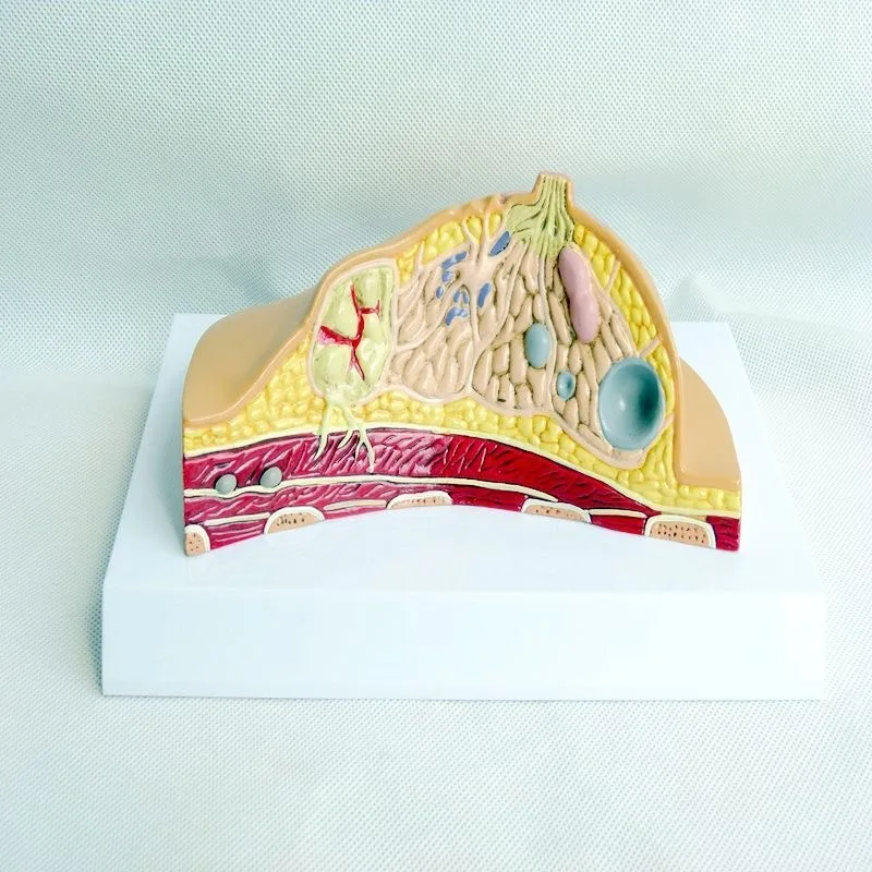 

High quality pathological breast anatomy model breast structure model
