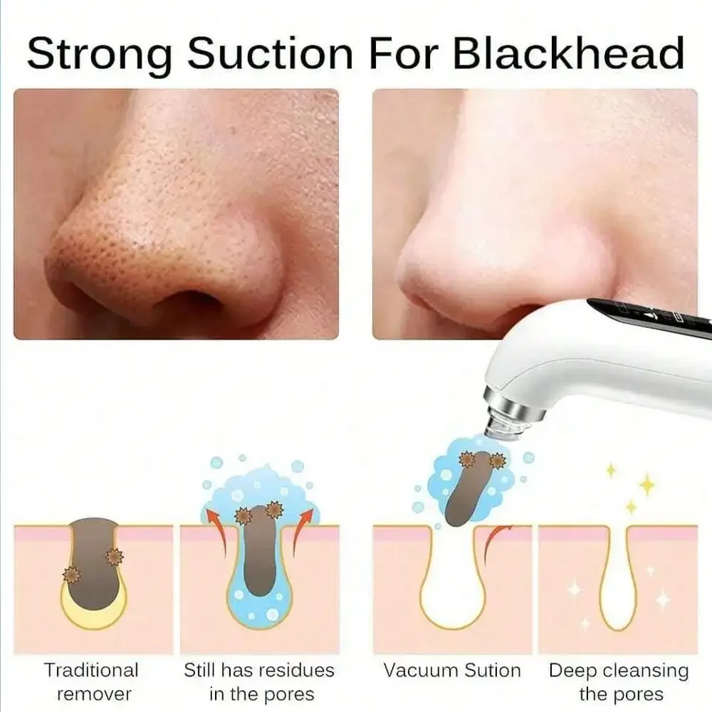 Blackhead Remover, Pore Vacuum Facial Cleaner, Electric Acne Remover, USB Charging Water Circulation Facial Cleaning Tool