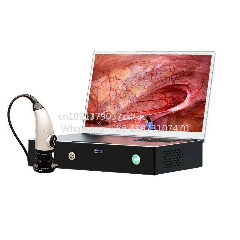 2026 New . ENT Portable MAC USB 3.0 HD 1080P Endoscope Camera With Folding 15inch Monitor