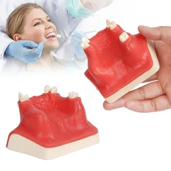 Dental Implant Model Upper Jaw Maxillary Sinus Lift Teaching Practice Model Oral Simulation Implant Soft Gingival Dentistry