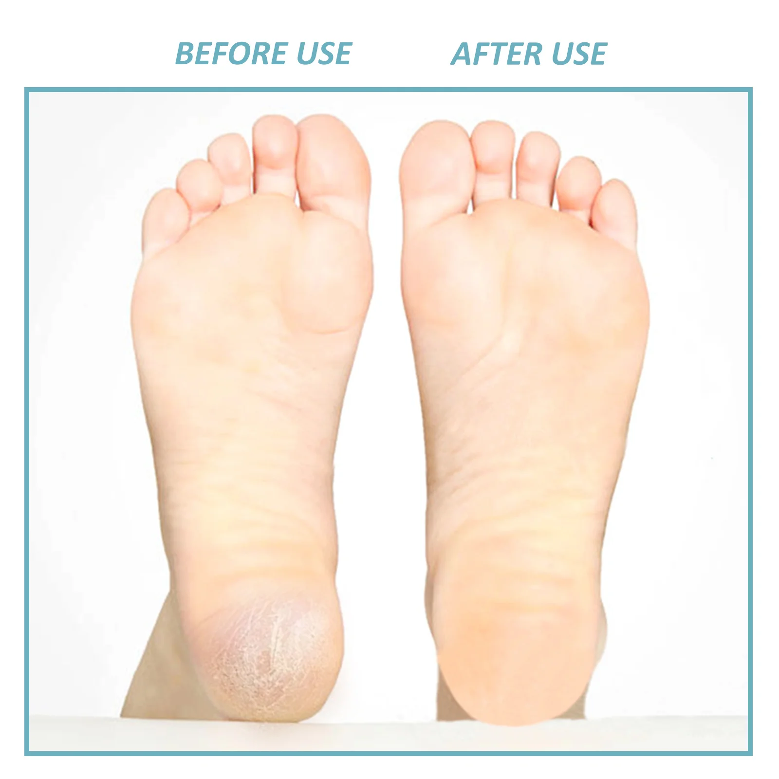 

5Pcs Foot Grinding Tools Durable Foot Callus Removers Safe Use Pedicure Set Dead Skin Hard Callus Remover