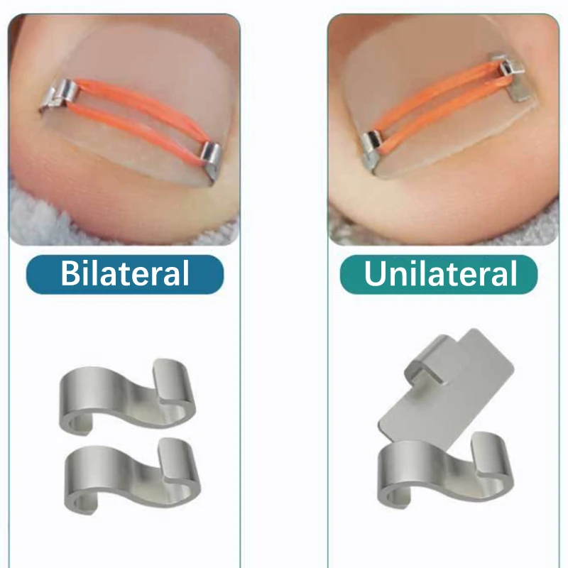 Strumenti per la correzione dell'unghia del piede incarnita Pedicure Recupera nel trattamento delle unghie dei piedi incorporati Strumento professionale per la cura del piede per la correzione dell'unghia del piede incarnita