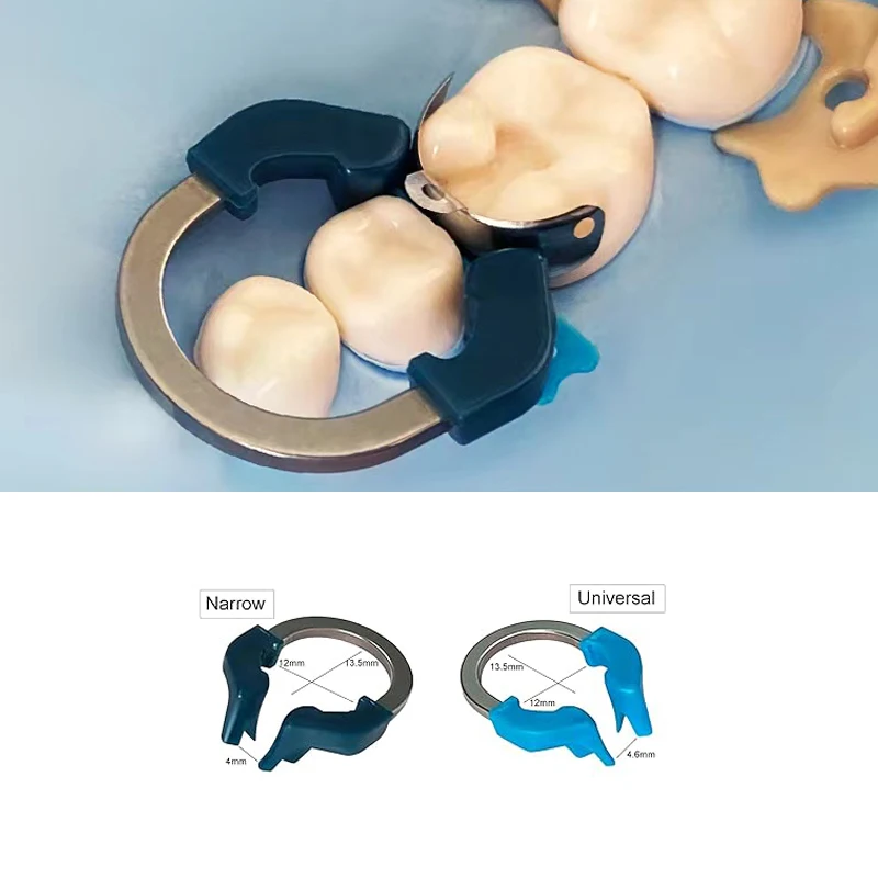 치과 매트릭스 밴드 NITI 금속 매트릭스 클램프 링, 논스틱 PTFE 코트, 단면 윤곽 매트릭스 시스템, 탄성 매트릭스 치과 의사