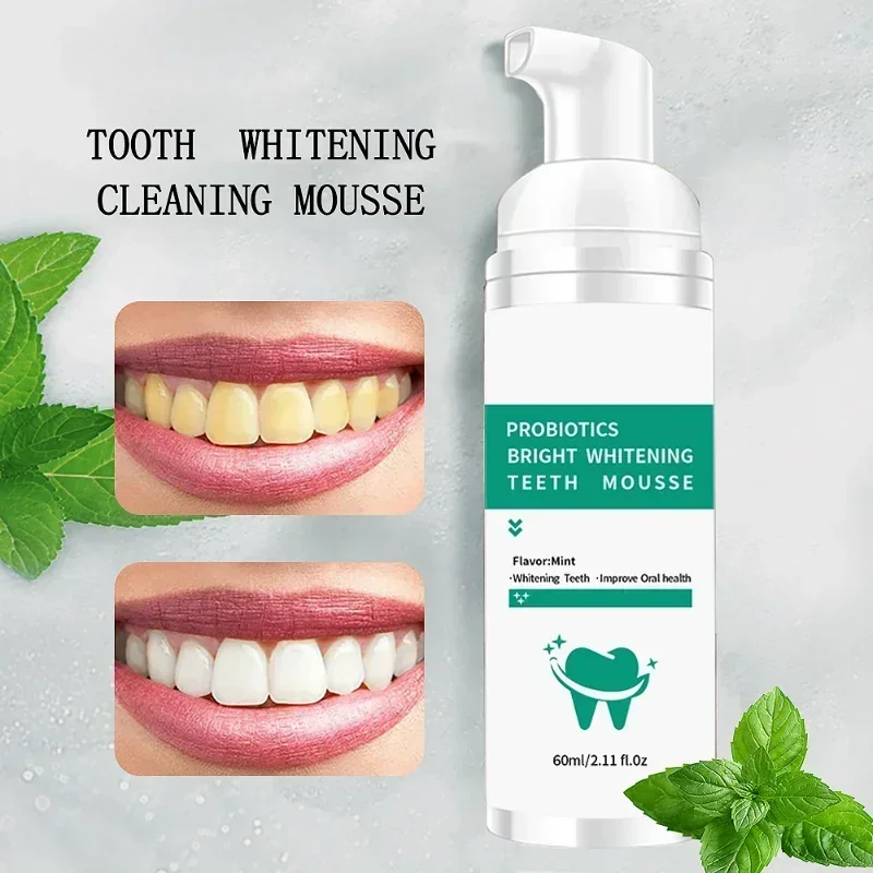 

Sdattor Teeth Cleansing Whitening Mousse Tooth Removes Stains Essence Oral Hygiene Dental Mousse Cleaning Tools Toothpaste For A