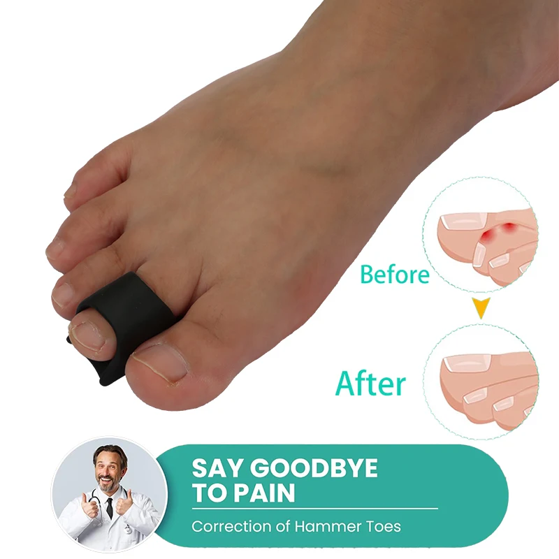 Pexmen 2/4 Stück Hammerzehenschutz, Zehenglättung für gekrümmte, verbogene, geklauten und überlappende Zehen, Hallux-Valgus-Pads – Detail 4