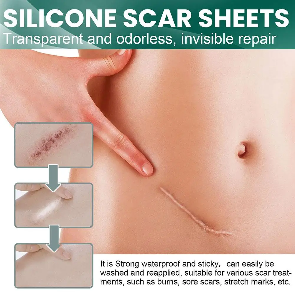 Waterproof Surgery-scar Removal Silicone Gel Sheet Therapy Patch Sticker Tape For Acne Trauma Burn Skin Repair-treatment F8j5