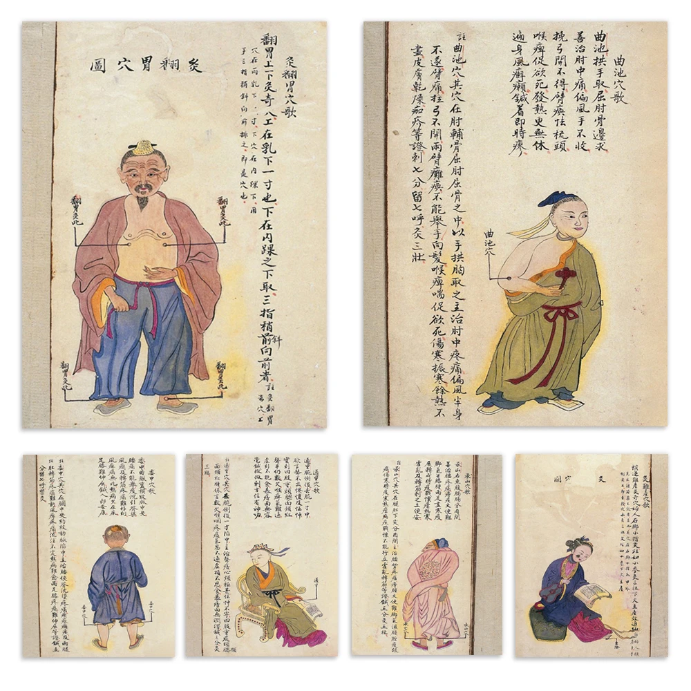 Chinese medicine moxibustion acupuncture point print, Hegu, scrofula point, Chengshan, traditional Chinese medicine poster art