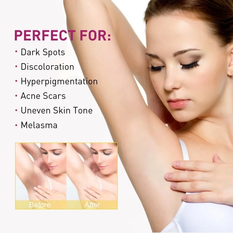 

Sdatter Body Whitening Cream Lip Underarm Knee repair whiten Armpit Elbow Thigh Inner Dullness Remove Melanin brighten skin Beau